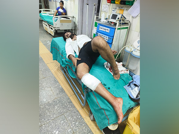  The accused, a member of the Kala Jatheri gang, was injured in police firing near Najafgarh (Photo/ANI)