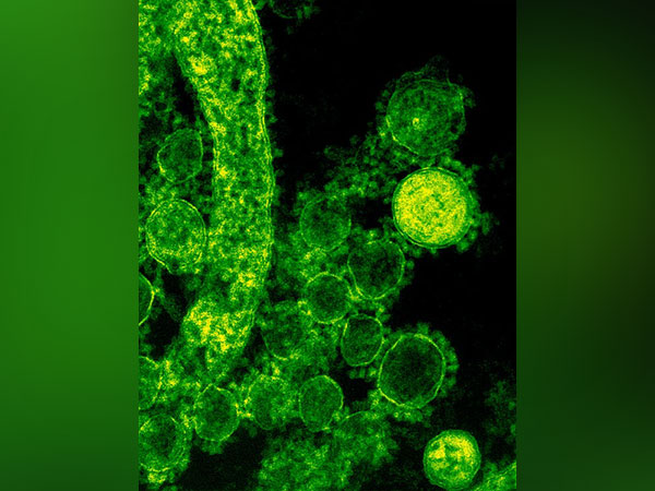 Representative image (File Photo: @Pexels)