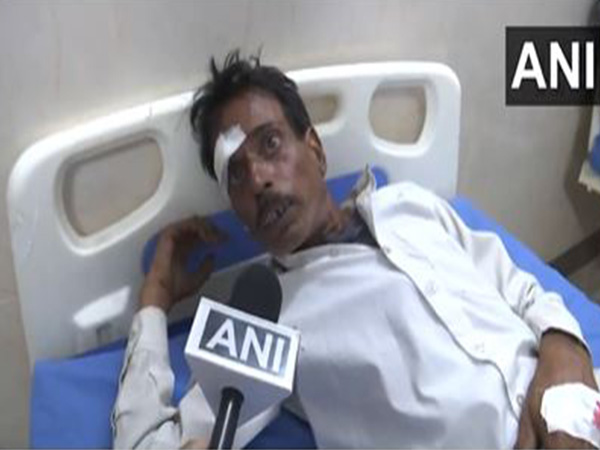 One of the injured people at GMC Anantnag. (Photo/ANI)