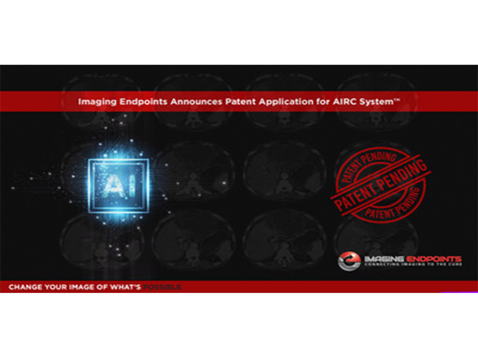 Imaging Endpoints Announces Patent Application for AIRC System™