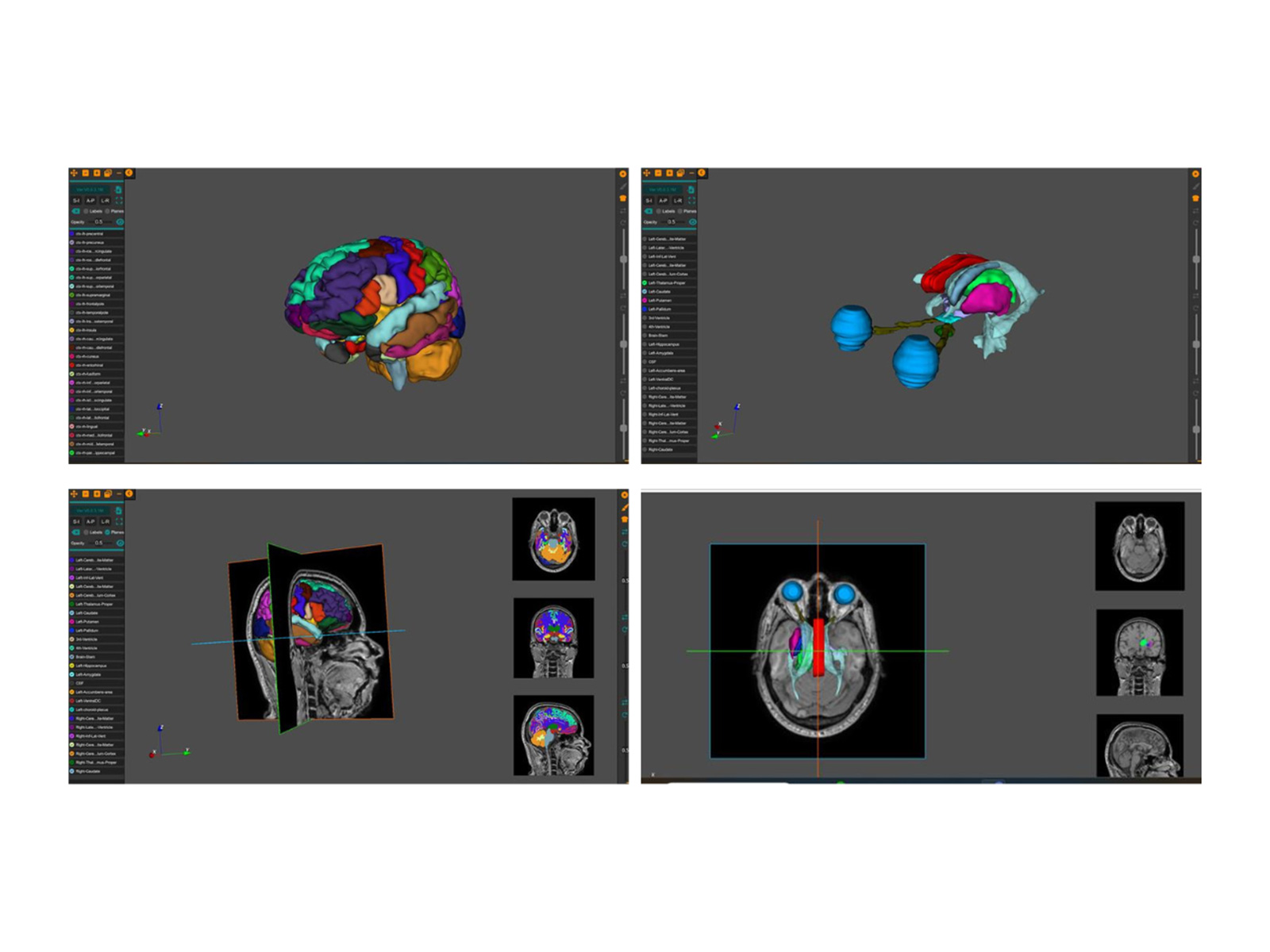 AnaVu: IIIT-Hyderabad’s 3D Anatomy Visualization Platform Transforming Medical Education