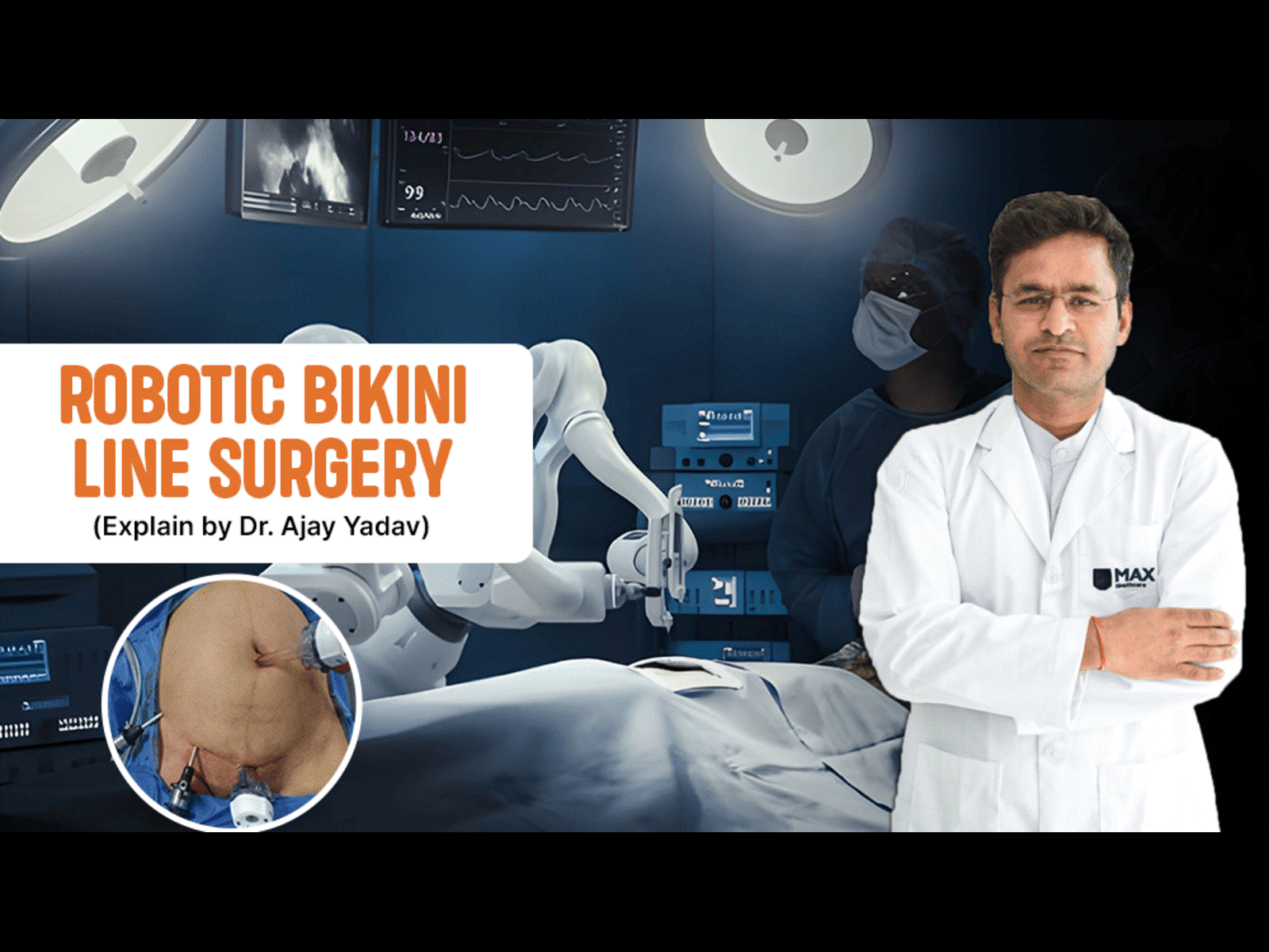 Robotic Bikini Line Surgery: A Modern Approach to Gallbladder Removal Robotic Bikini Line Surgery: A Modern Approach to Gallbladder Removal
