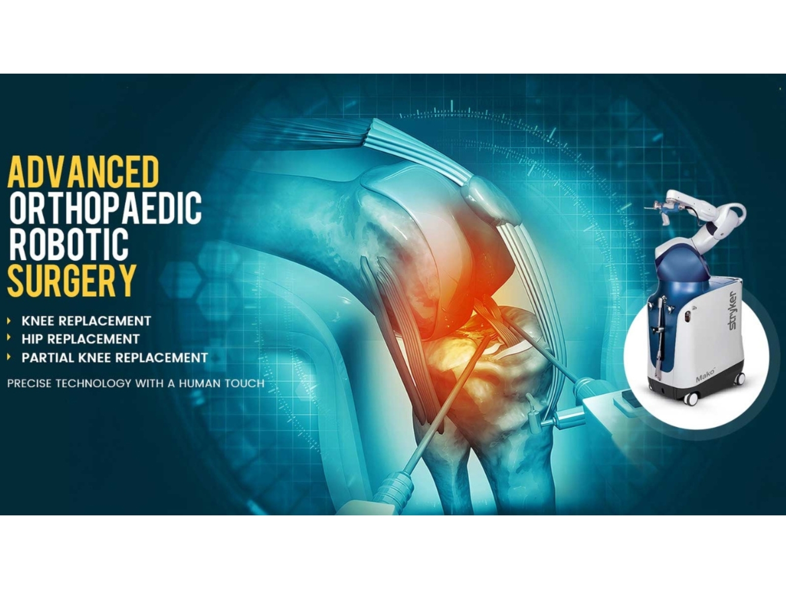 All About Robotic Knee Replacement at Jehangir Hospital Transforming Lives with Precision and Care