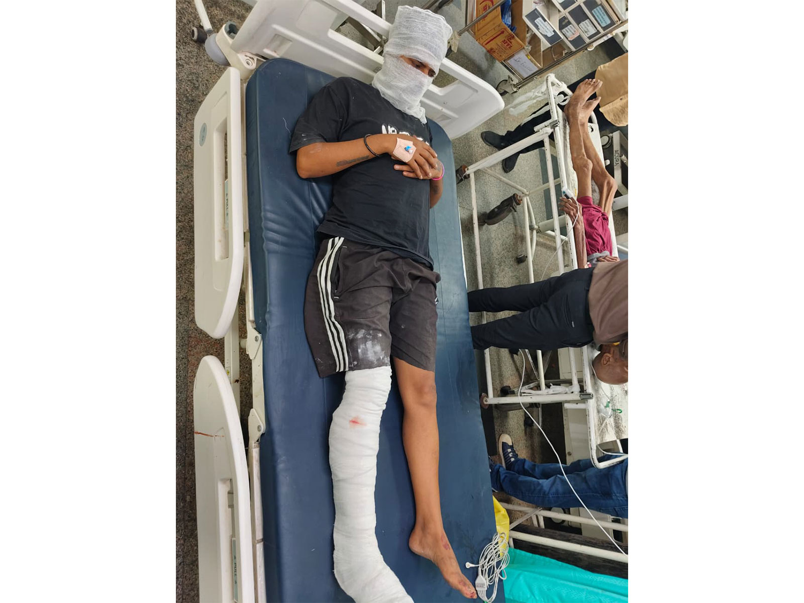 Wanted criminal in hospital after conflict with police (Photo/ANI)