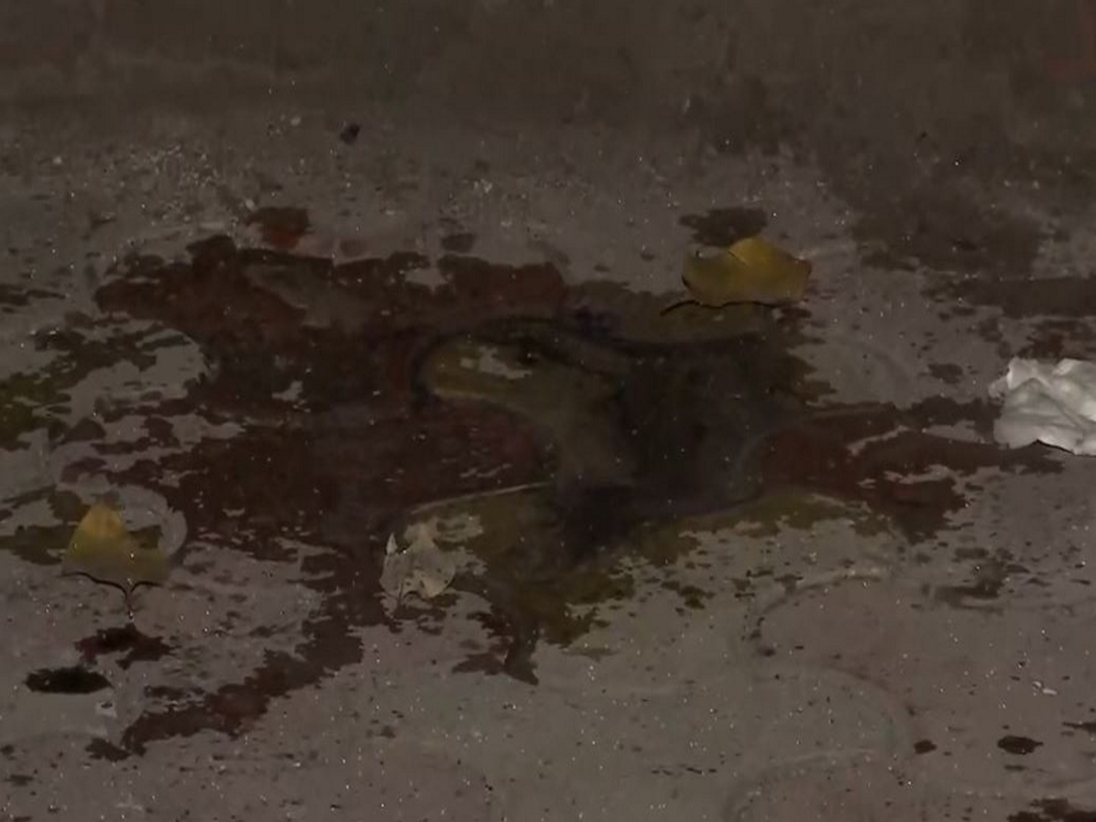 DU student attacked with acid (Photo/ANI)