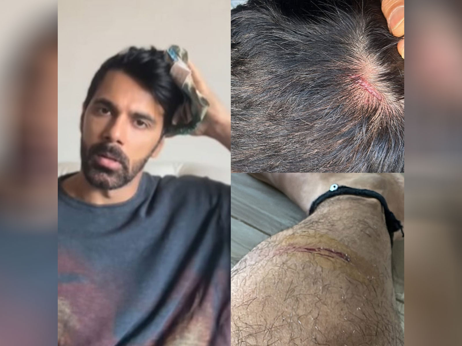 Anuj Sachdeva (Photo/instagram/@apnanuj)