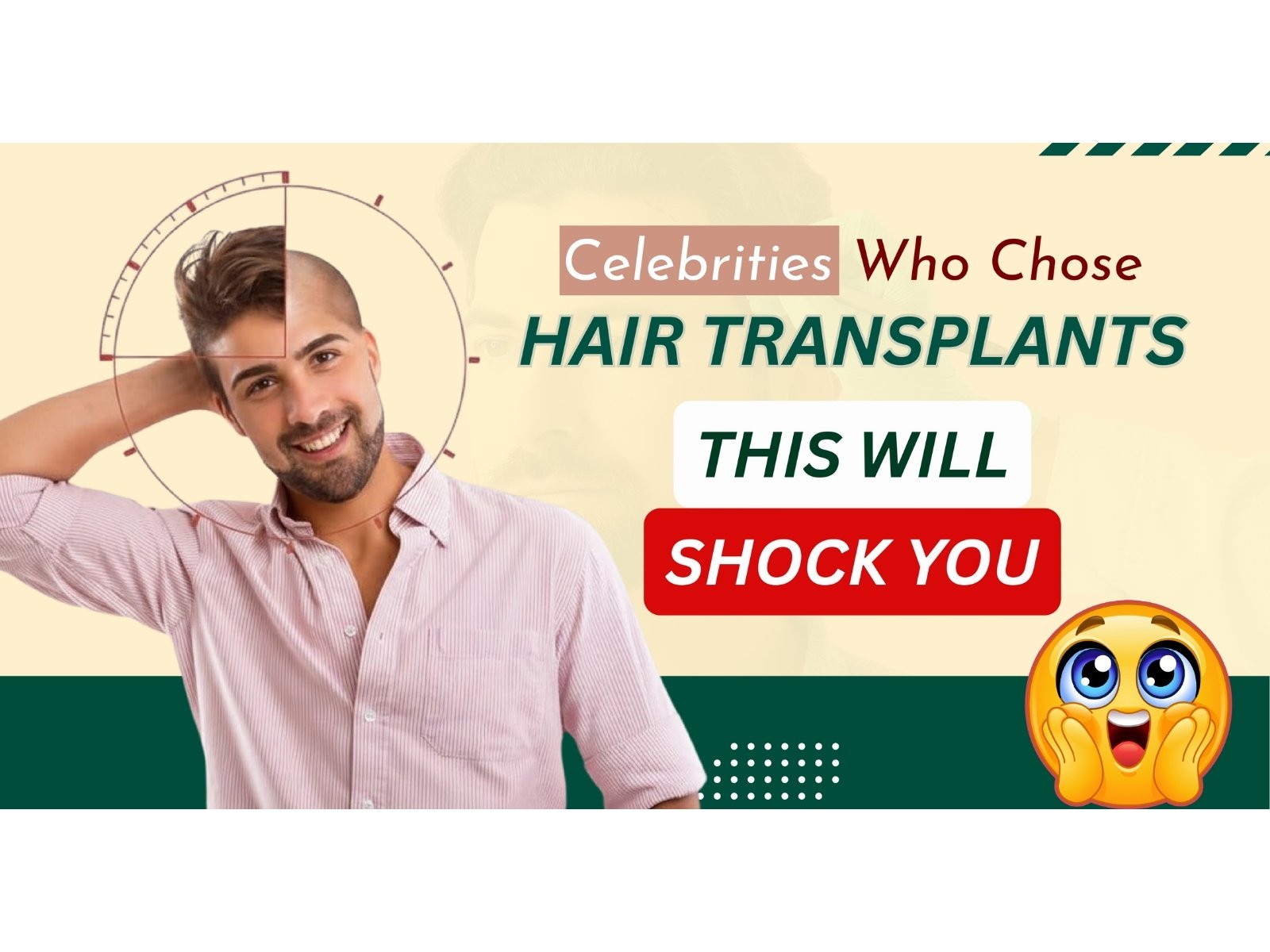 Celebrity Hair Transplant: You’d Never Guess They Had a Hair Transplant- But They Did