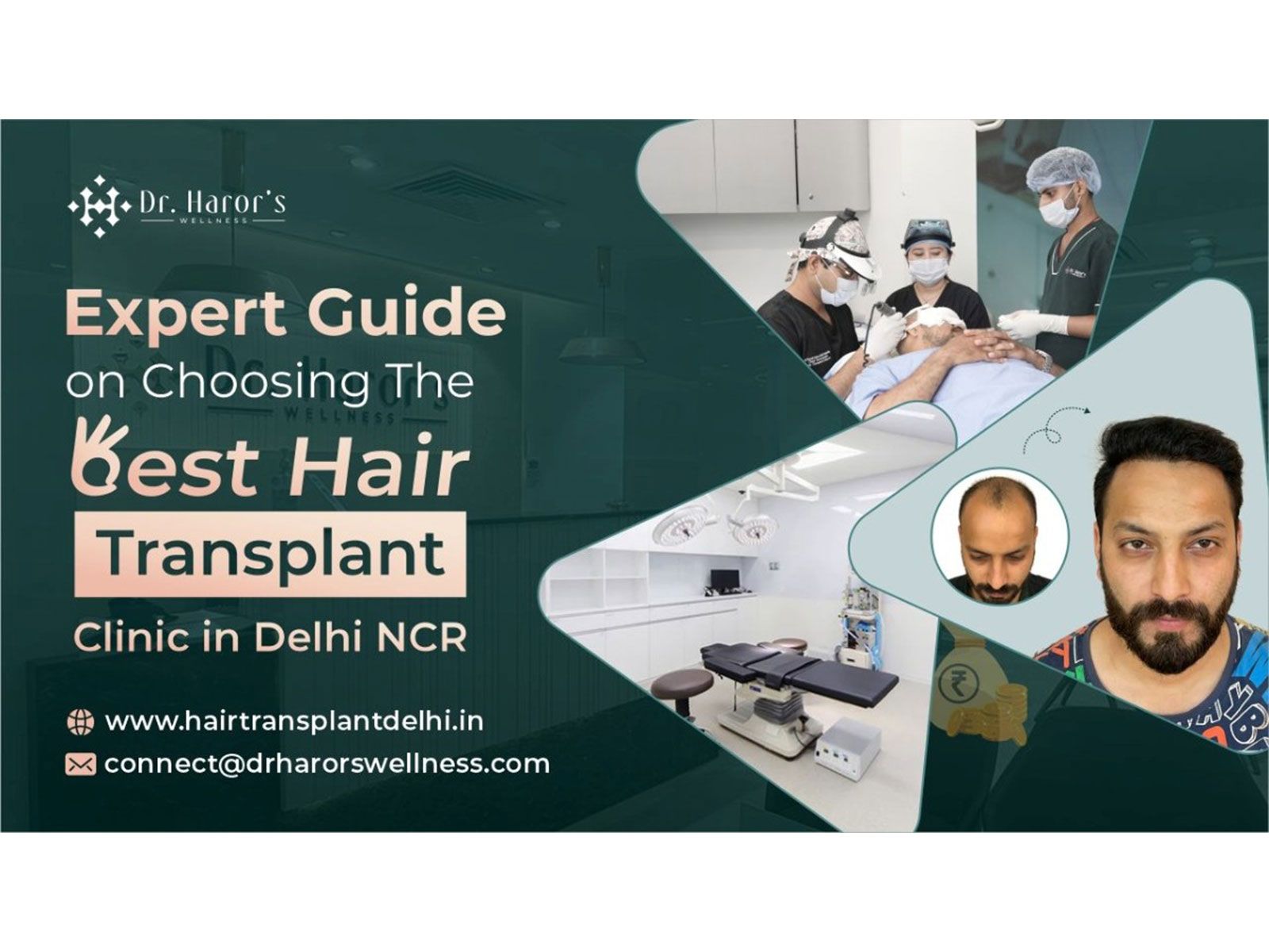 Expert Guide on Choosing the Best Hair Transplant Clinic in Delhi NCR Expert Guide on Choosing the Best Hair Transplant Clinic in Delhi NCR