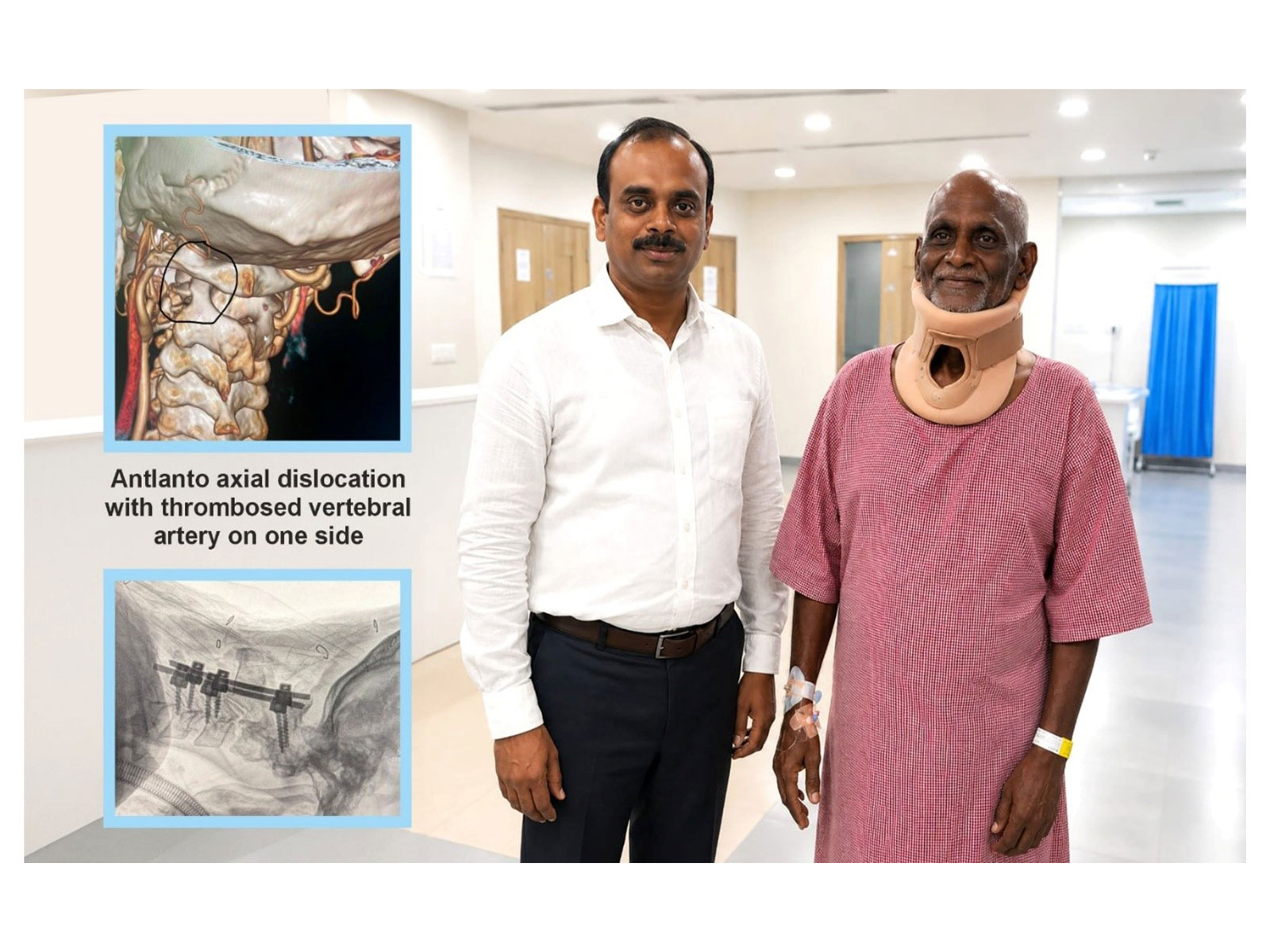 Medicover Hospitals Neurosurgeon Successfully Treats 72-Year-Old with Life-Threatening Cervical Spine Injury