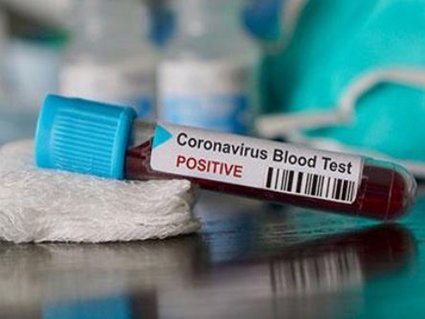 With 1,486 new cases and 49 deaths in the last 24 hours, India's total number of coronavirus positive cases have risen to 20,471 while the toll stands at 652 on Wednesday.