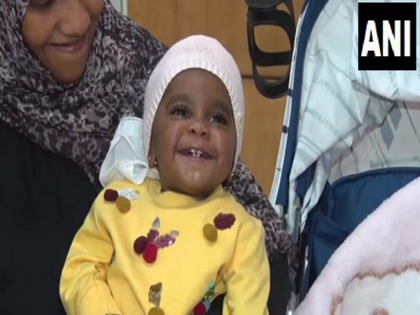 Doctors of Artemis hospital performed a liver transplant of a one-year-old girl child 'Hoor' of Saudi Arabia (Photo/ANI)