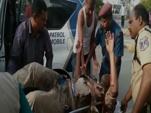 Narsimha being shifted to a hospital after he suffered burn injuries on Friday in Hyderabad. Photo/ANI