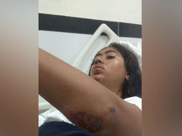 Joymala Bagchi being treated for her injuries at AIIMS New Delhi. Photo/ANI