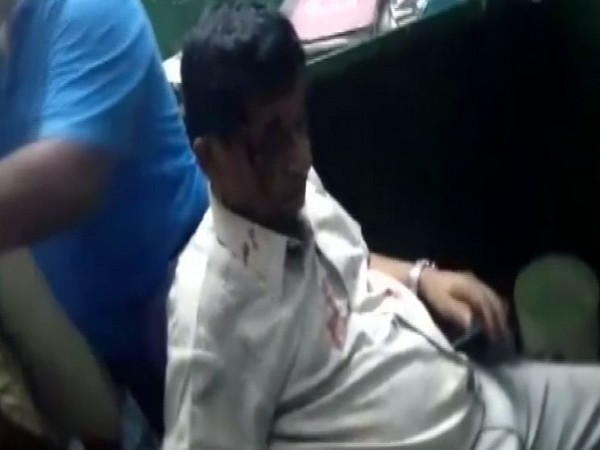 A 73-year-old doctor was allegedly beaten to death by a tea garden worker's family in Jorhat, Assam. (Photo/ANI)
