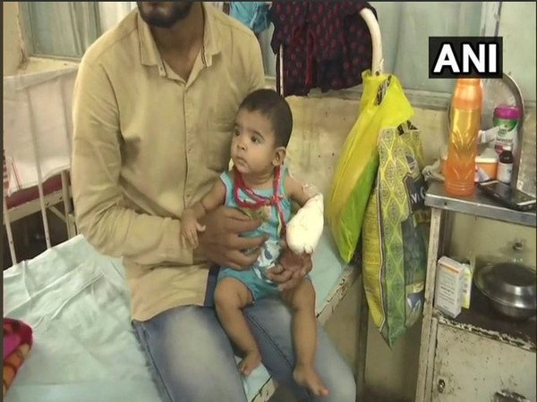 The affected child with her left arm bandaged