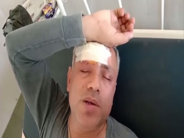 Asaram case prime witnesses Mohinder Chawla was assaulted in Panipat. Photo/ANI