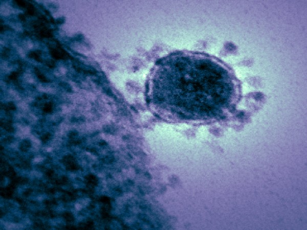 The study notes that the patients who became infected with the virus were exposed to wildlife animals at a wholesale market