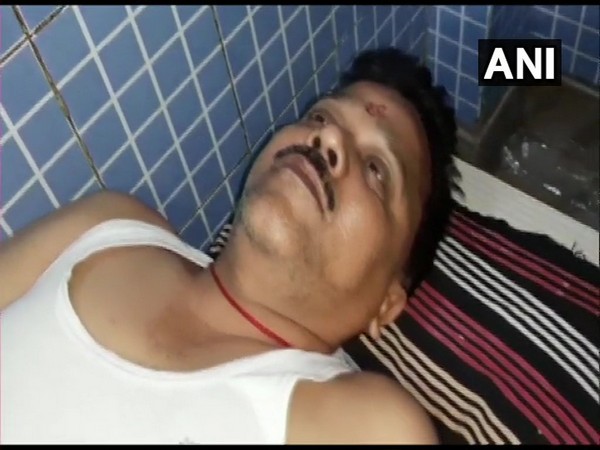 The injured jeweller Raju Shah undergoing treatment at a hospital. Photo/ANI