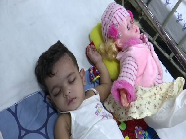 The 11-month-old Zikra receiving treatment with her doll at Lok Nayak Hospital in Delhi. Photo/ANI