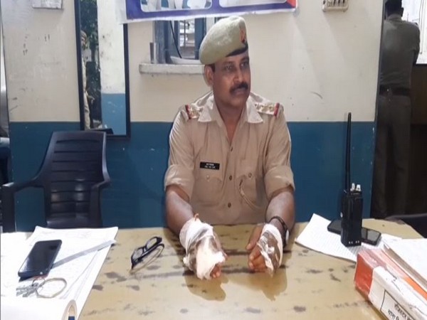 A police personnel sustained burn injuries in UP's Meerut. (Photo/ANI)