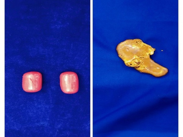 The gold seized from a passenger at Chennai airport. (Photo/ANI)