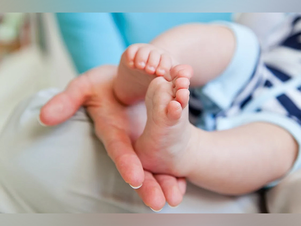 Representative image