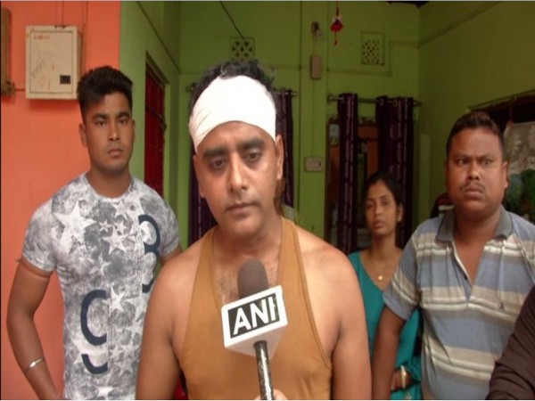 Gautam Mondal, brother of booth president of BJP in Siliguri, after he was allegedly attacked by TMC goons. Photo/ANI