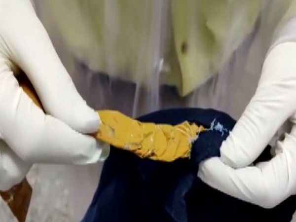 Air intelligence unit of Kozhikode airport seized gold worth around Rs 1.50 crore.