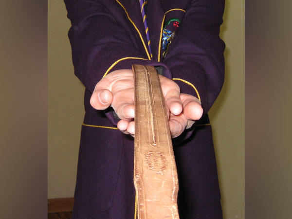 Representative image