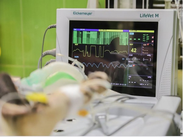 Representative image