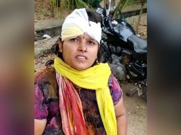 Women brutally thrashed by neighbours while performing puja at home in Hyderabad. Photo/ANI