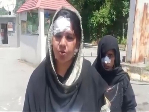 Police atrocities are on rise in PoK amid Covid-19 lockdown. Photo/ANI 