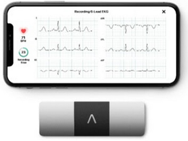 KardiaMobile 6L is the world's only six-lead, FDA-cleared personal ECG