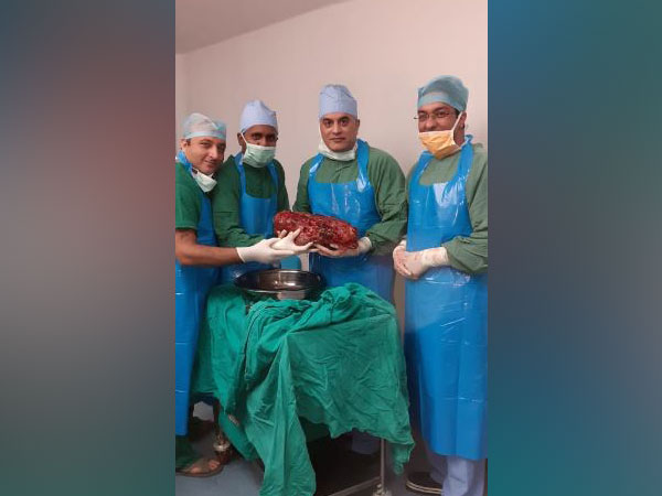 Doctors at Sir Ganga Ram Ram Hospital with the kidney removed from the patient. Photo/ANI