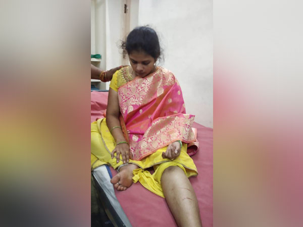 Leopard attacks two women travelling to Tirumala Photo/ANI