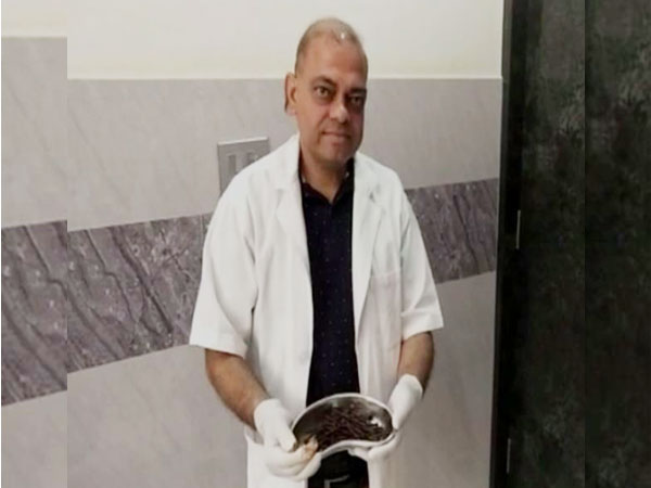 Dr Anil Saini had done the operation and removed 116 nails from man's stomach. Photo/ANI