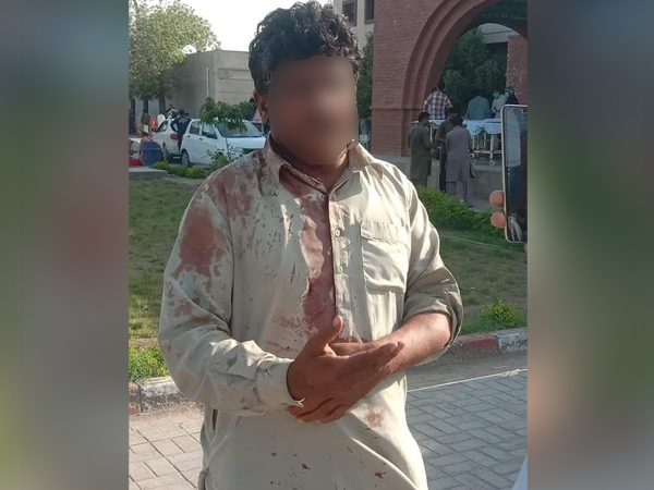 The pastor who was brutally beaten and forced to leave the area in Rahim Yar Khan city of Pakistan's Punjab province.