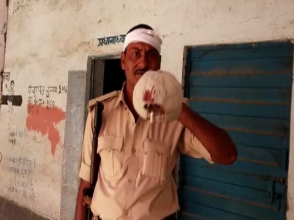 A police officer on polling duty, who was attacked in Bihar's Arrah,for preventing bogus voting on Sunday. Photo/ANI