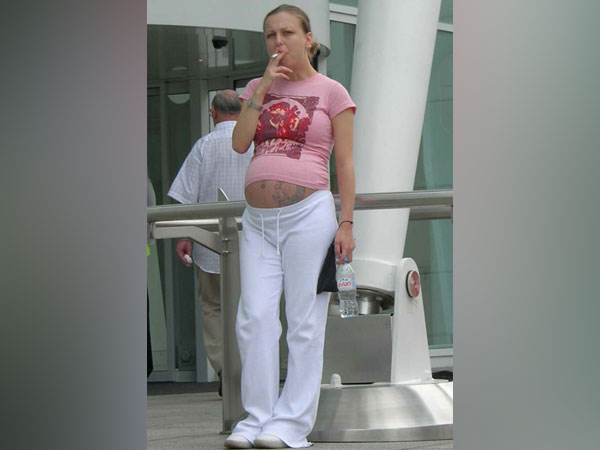 Representative image