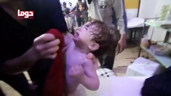 A victim of April 2018 chemical attack in Syria's Douma