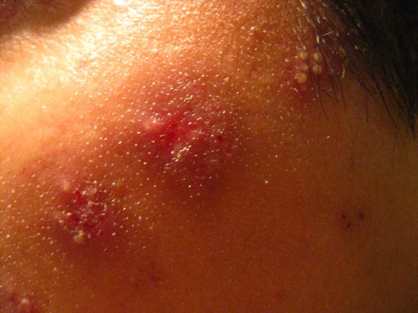 Representational Image