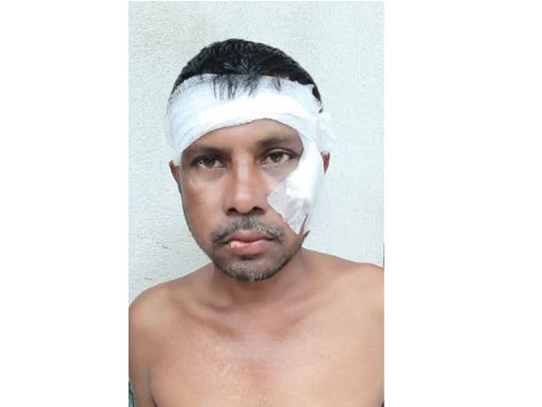 TMC worker Ranjit Mondal (Photo/ANI)