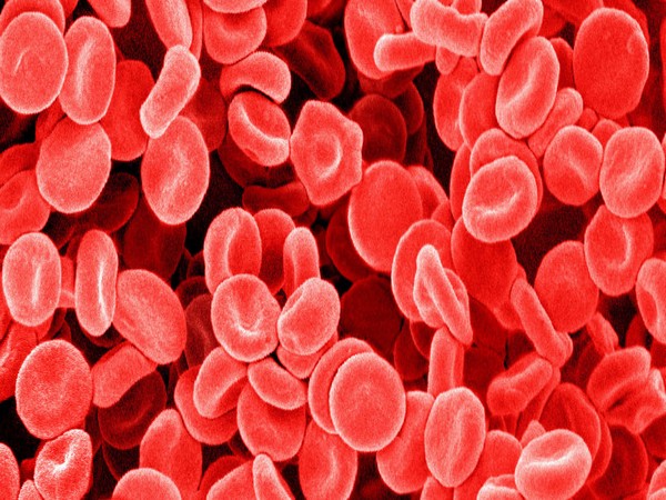 Representational Image