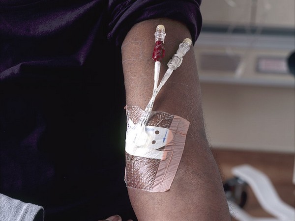 Representative image