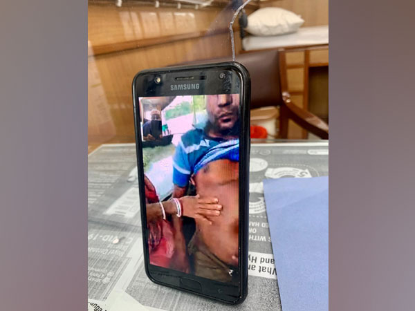 Doctors of Sir Ganga Ram Hospital saved the life of man in Assam during floods (Photo/ANI)