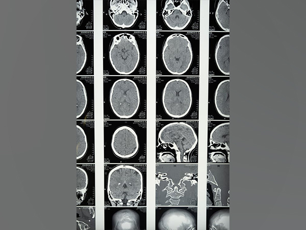 Representative Image