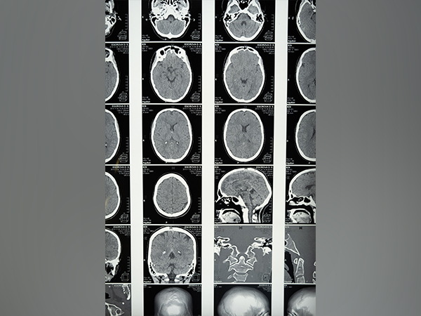 Representative Image