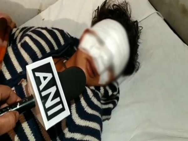 Victim was treated in a hospital in Moradabad, Uttar Pradesh (Photo/ANI)