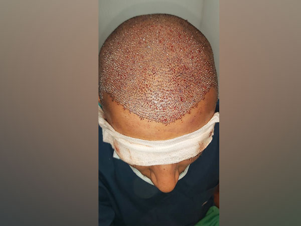 Representative image