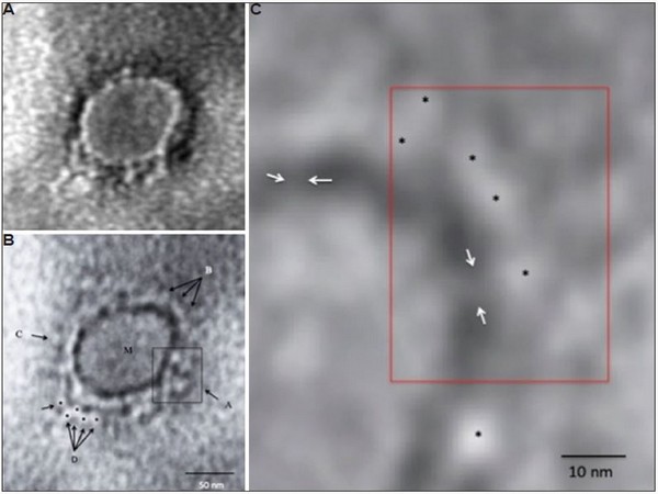 Microscopic image of  SARS-CoV-2 virus.